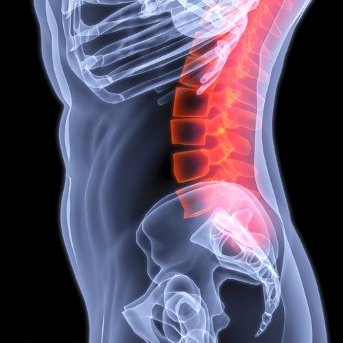 AVOIDING FBSS IT S UP TO YOU Whether you are considering spinal surgery in the future, or you or someone you care about have undergone surgery already and suspect FBSS, there is one doctor in the New