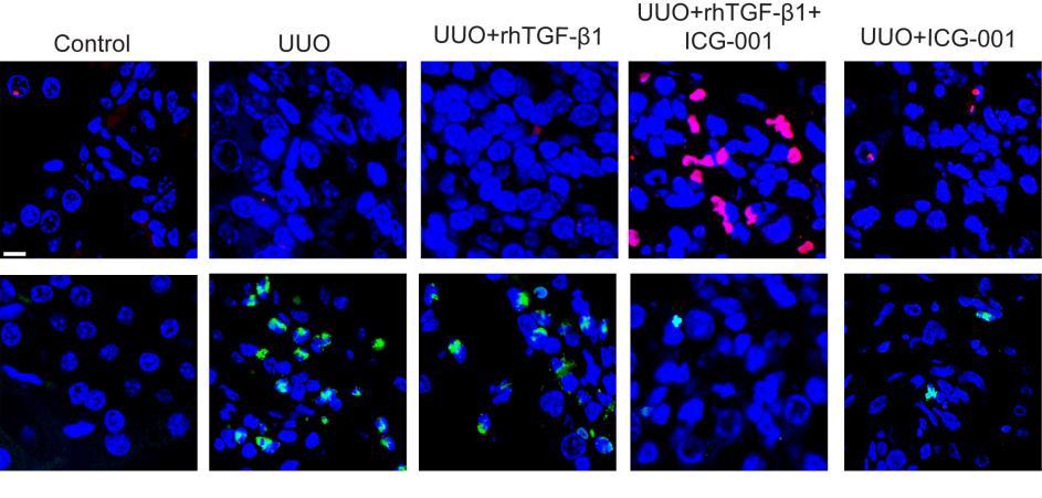 Inhibition of β-catenin/tcf by ICG-001 increases