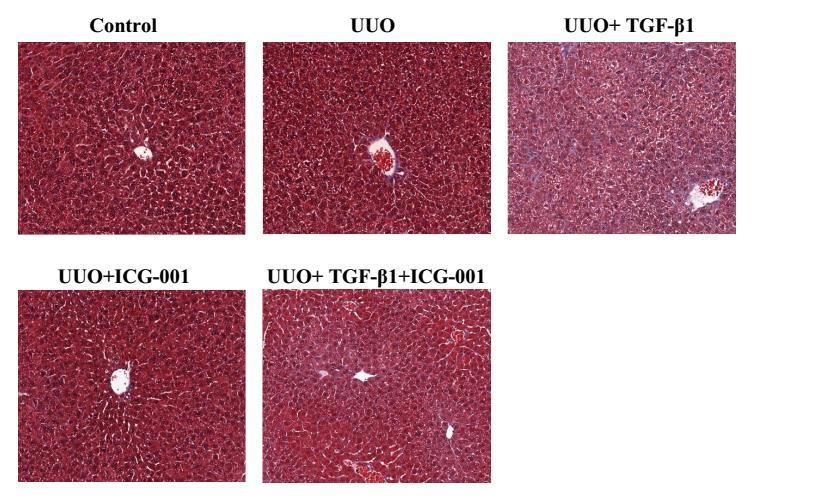 Liver fibrosis score Inhibition of β-catenin/tcf interaction by ICG-001 prevents TGF-β1- induced distant organ fibrosis (liver) 2.