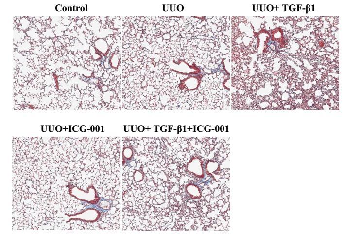 Lung fibrotic area (%) Inhibition of β-catenin/tcf interaction by ICG-001 prevents TGF-β1- induced distant organ fibrosis (lung) 35 30