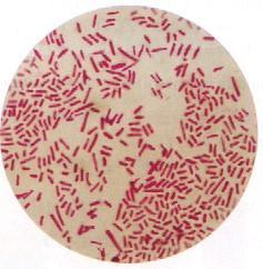 Identification of Enterobacteriaceae Gram stain All