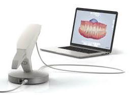 HOW TO PROVIDE 3SHAPE TRIOS INTRAORAL SCANS FOR THE PRODUCTION OF SOMNODENT DEVICE. TRIOS BY 3SHAPE KEY QUESTIONS: 1 How do I send my case?