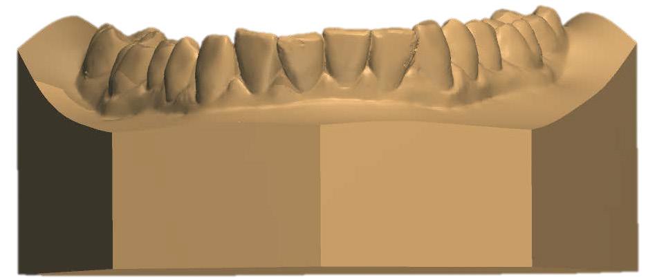 teeth in opposing arches.