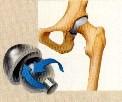 Arthrokinematics Manner in which adjoining joint surfaces move in relation