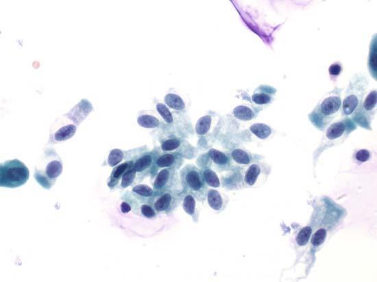 Normal Urothelial Histology and Cytology 13 Figure 1.6.