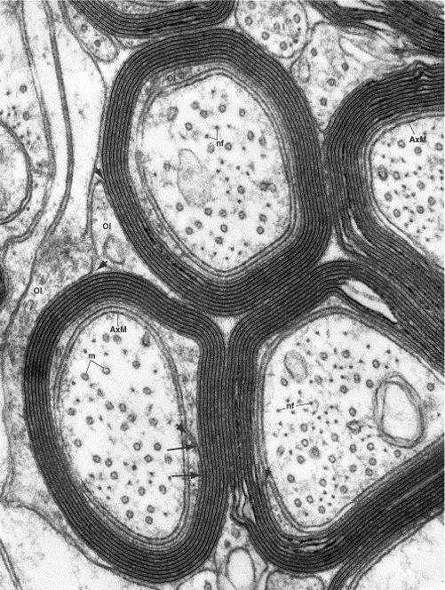 around an axon: Schwann cells in