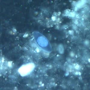 Epifluorescence Cyclospora cayetanensis Cystoisospora belli Images from