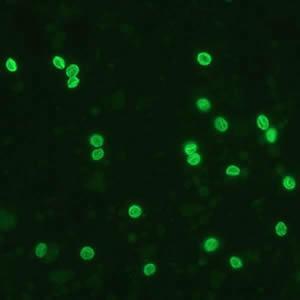 Direct Fluorescent Antibody