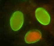 Giardia cysts Image from CDC WISCONSIN