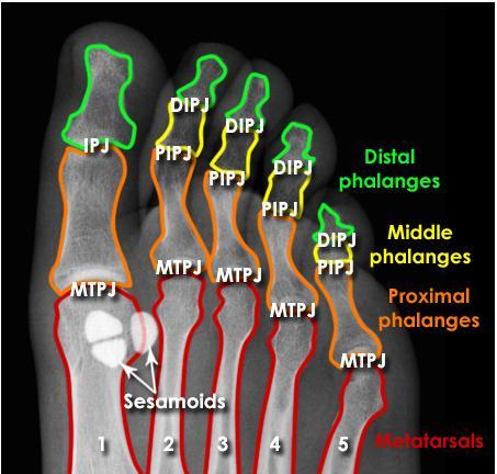 Forefoot X-ray anatomy - Joints MTPJ = Metatarsophalangeal Joints IPJ = Interphalangeal Joint (of big toe only) PIPJ = Proximal Interphalangeal