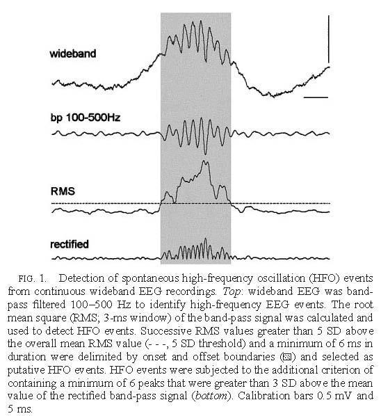 Analysis of high frequency oscillations (HFOs) Bandpass filter wideband signal between 100 and 500Hz (FIR).