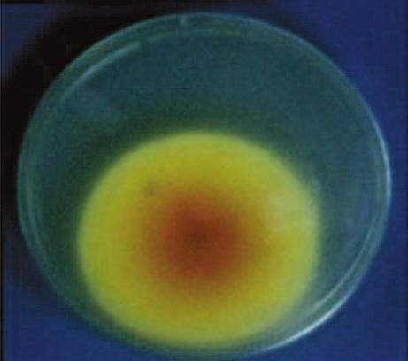 agar) in a row of C-shaped streaks. The Sabourand s dextrose plates were observed for 21 days in room temperature.