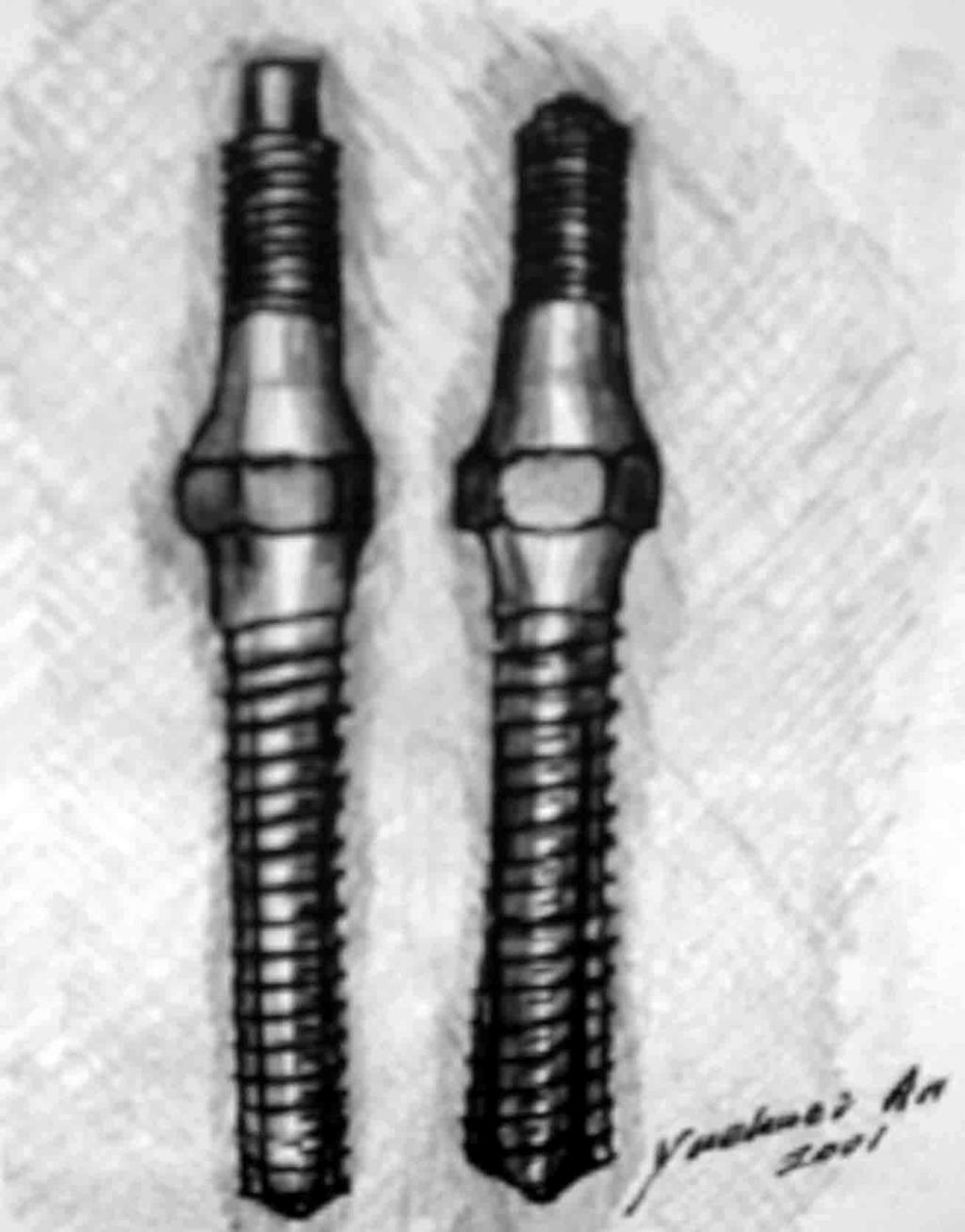MODIFIED IMPLANTS EXPANDABLE SCREWS Cylinder inserted into screw shaft which then expands 50% greater holding