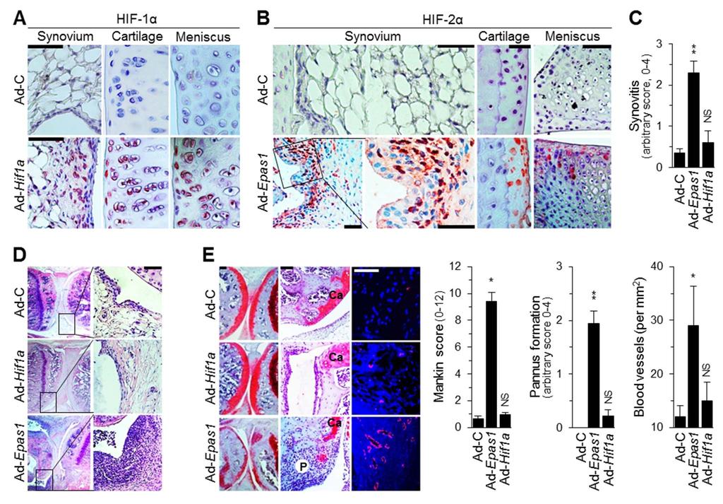 Figure 2. Overexpression of HIF-2a, but not HIF-1a, in joint tissues causes an RA-like phenotype in mice. DBA/1J mice were IA-injected with 1610 9 PFU of empty virus (Ad-C), Ad-Epas1, or Ad-Hif1a.
