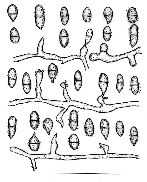 Comments: The new taxon differs from all the species in the genus Scolecobasidium whose conidia are 2 celled, broadly ellipsoidal to subglobose, and conidial L/W<2. Fig.