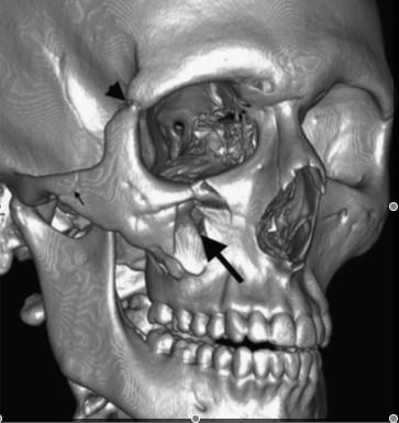 3 Imaging modalities in head and neck pathology & trauma and cheaper than conventional CT scanners, and the patient sits upright, like in a dental panoramic tomography unit.