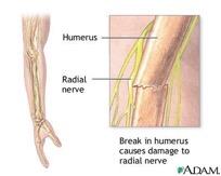 Upper Arm Injuries Humerus is the longest bone and is usually fractured at the