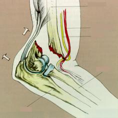 Care for Elbow Injuries Injury to this area can be