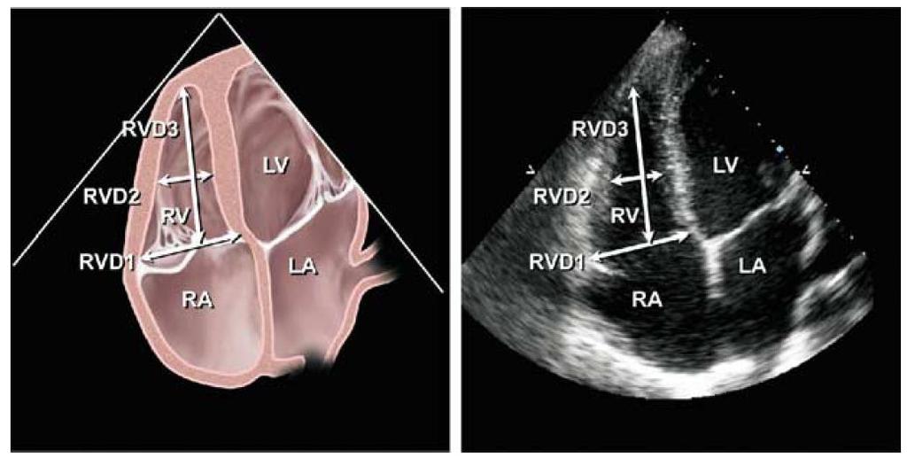 Echocardiography of the Right Heart Guidelines of the