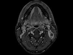 Radiology MRI Advantages : Safety ( pregnancy ) Non invasive, Soft tissue assessment, Skull