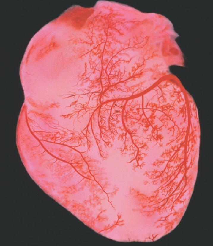Cardiovascular The Cardiovascular System - Arteries Arteries Cardiovascular System Function of the cardiovascular system is to transport blood containing: Carry blood