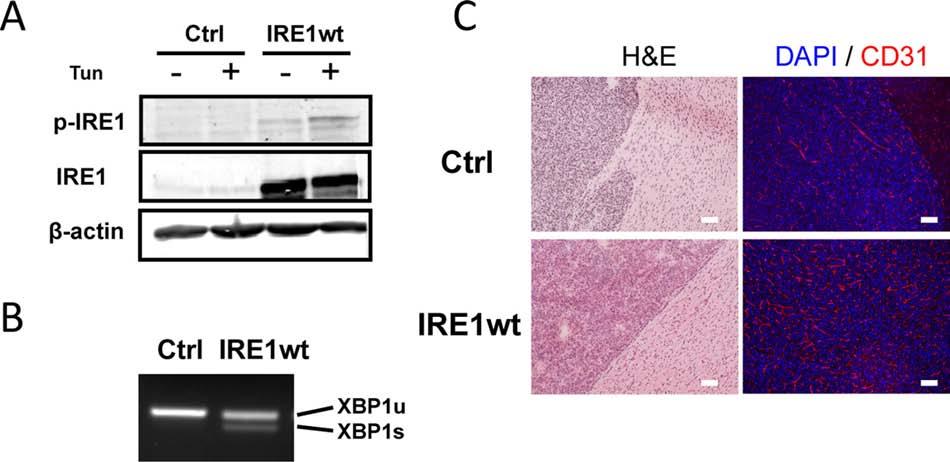 Supplementary Figure S2: Ectopic expression of IRE1wt protein does not affect significantly the angiogenic and non-invasive characteristics of U87 cell-derived gliomas.