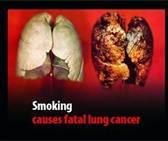 Disease caused by Tobacco Cancer - Lung cancer, is directly linked to cigarette smoking. http://whyquit.com/wh yquit/a_noni.
