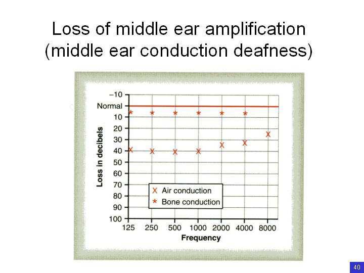 The scale on the vertical axis is hearing loss in db, so normal hearing would be a straight line on 0dB.
