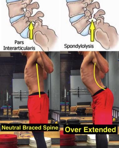 The lower back is also critically involved in our body's movements throughout the day, as we twist the torso in rotating side to side and as we hinge the back in flexion and extension while bending