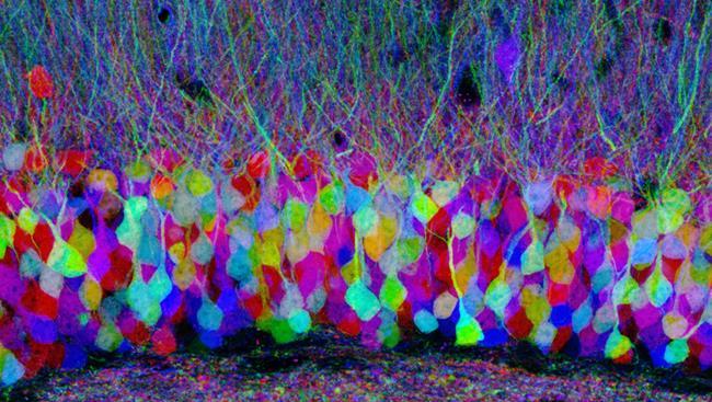Hundreds of billions of neurons are in the brain and much research is being devoted to mapping