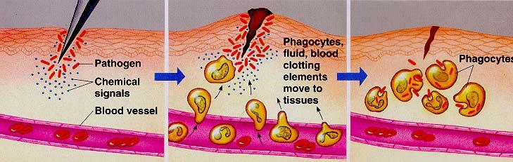 Summary of Inflammation Injury to tissues releases mediators of inflammation, cytokines, histamine, and prostaglandins (PGE2) Vasodilation, increased blood flow (rubor, calore) Increased capillary