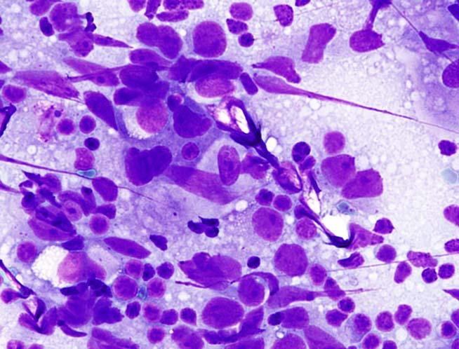 WM Mixed population of lymphocytes