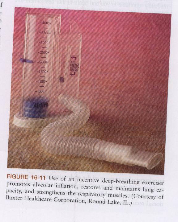 9. Incentive Spirometry - done to