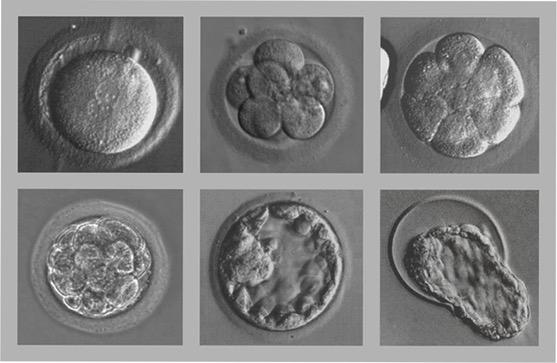 STAGES OF EMBRYO DEVELOPMENT Day 1: Zygote Day 3: MulB-celluar