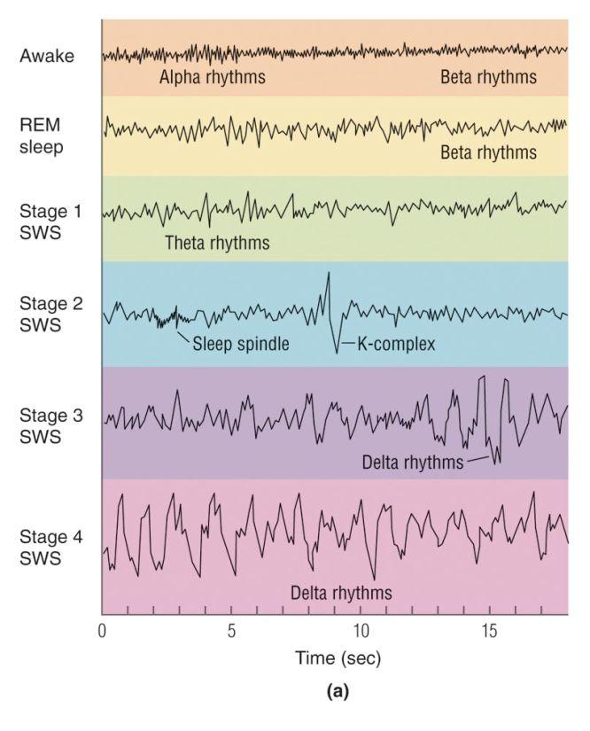 Rapid-eye-movement sleep (REM) is characterized by an EEG resembling wakefulness. 90 120 minute cycles characterize both sleep and wakefulness. Copyright@Houghton Mifflin Company Company.
