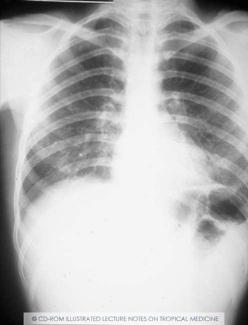 pulmonary phase Transverse