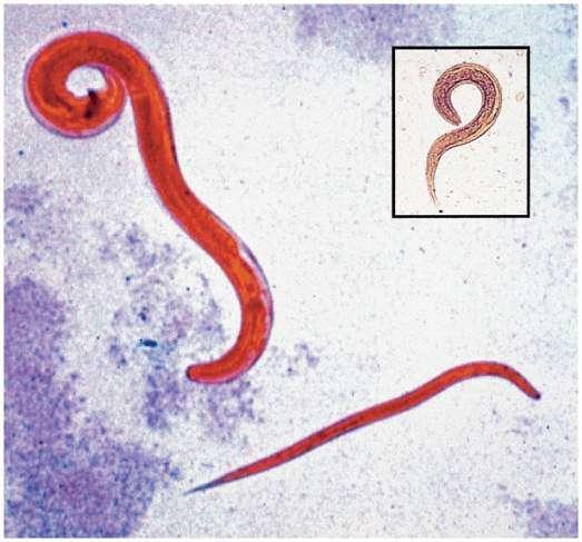 Strongyloides Rhabditiform Larvae may transform to Filariform Larvae penetrating perianal skin and