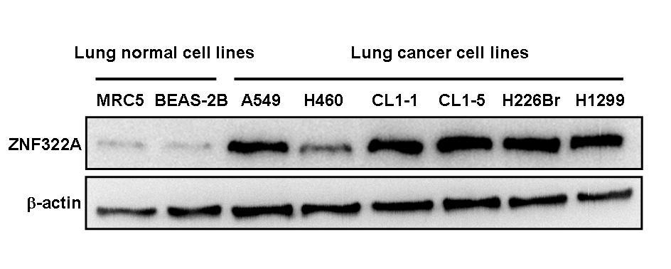 Figure S3. ZNF322A expression level among various lung cell lines.