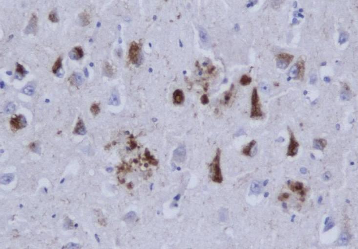 The brain in Alzheimer s disease