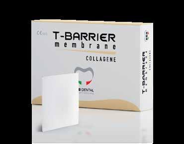 T-BARRIER COLLAGEN MEMBRANE T-Barrier collagen membrane is a type-1 native heterologous equine collagen indicated in guided tissue regeneration procedures to enhance wound healing.