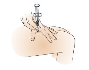 Fig ure 8. Inserting the needle into your thig h. 3. Using your index finger, push the plunger gently to inject the medication into your thigh (see Figure 9). Fig ure 9.