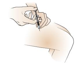 Press down at the injection site with the gauze for a few seconds. Cover the injection site with a bandag e (Band-Aid ). 6. Place the syringe and needle into the sharps container.