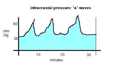 A-waves Pathological A waves (also called plateau waves) are abrupt, marked elevations in ICP of 50 to 100 mmhg, which usually last