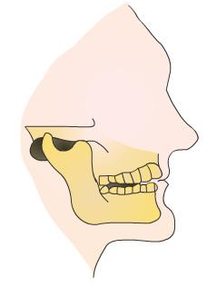 This reference summary explains temporomandibular joint disorders. It reviews the anatomy of the jaw, symptoms, causes, diagnosis, and treatment options for TMJ disorders.