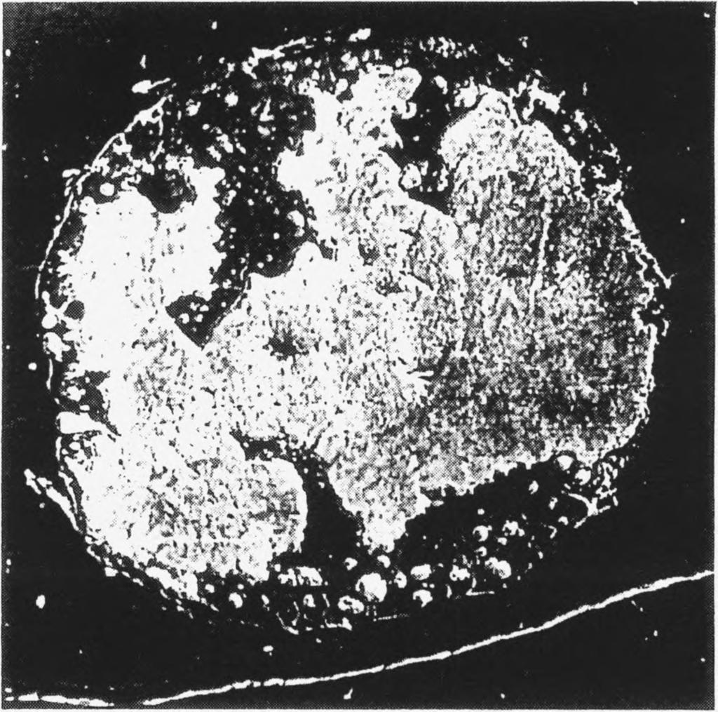 Evaluation of acid etch biopsy technique, Hotz ct al, (1970) The amount of enamel removed from the 30 teeth ranged from 93,2 pg to 209,4 pg with a mean of 161,3 /xg (S.D. ± 31,3).