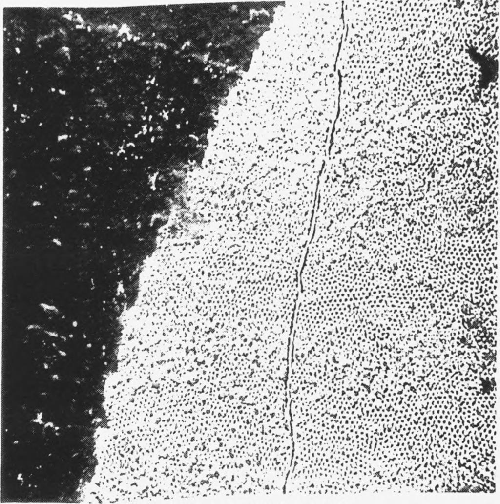 These factors may result in parts of the enamel surfaces being covered with a protective coating which will prevent them from being etched. Fig. 12. Exposed prism-ends on etched surface. SEM x 1 000.