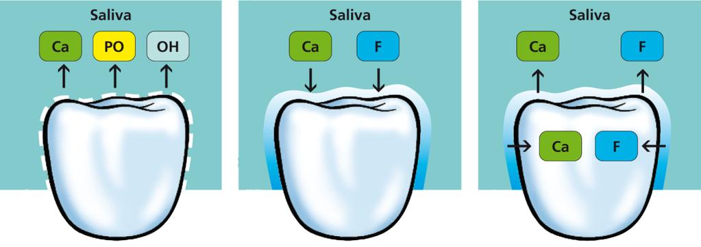 Fluoride varnish Mechanism of action Acidic oral environment Neutral oral environment Acidic oral environment The tooth structure
