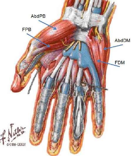 MUSCLES OF THE HAND - The aponeurosis is divided into three compartments (thenar, hypothenar and middle) - there are 4 layers LAYER 1: HYPOTHENAR + THENAR A) thenar muscles o abductor pollicis brevis