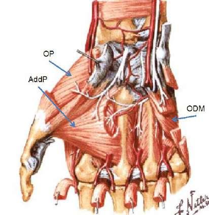 - the adductor pollicis is a fan shaped muscle with two heads, an oblique head that starts at the base of the 2 nd and 3 rd metacarpal, and a transverse head that starts on the shaft of the third