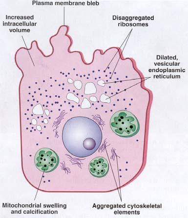 Ultrastructural features of reversible cell injury Reversible cell injury = degeneration Cells have normal